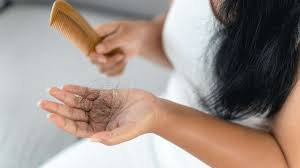 QUEDA DE CABELO NAS MULHERES: O ALERTA QUE NINGUÉM QUER OUVIR, MAS TODAS PRECISAM SABER