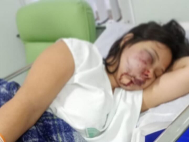 ADOLESCENTE GRÁVIDA É AGREDIDA EM GUARULHOS E CASO DE VIOLÊNCIA CAUSA REVOLTA