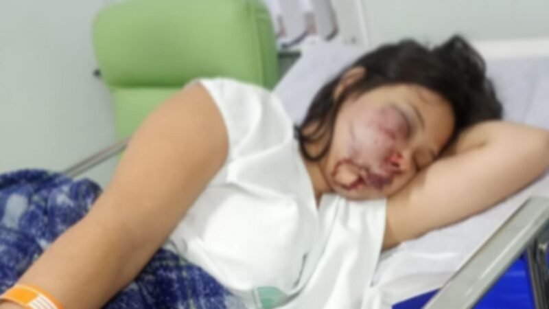 ADOLESCENTE GRÁVIDA É AGREDIDA EM GUARULHOS E CASO DE VIOLÊNCIA CAUSA REVOLTA