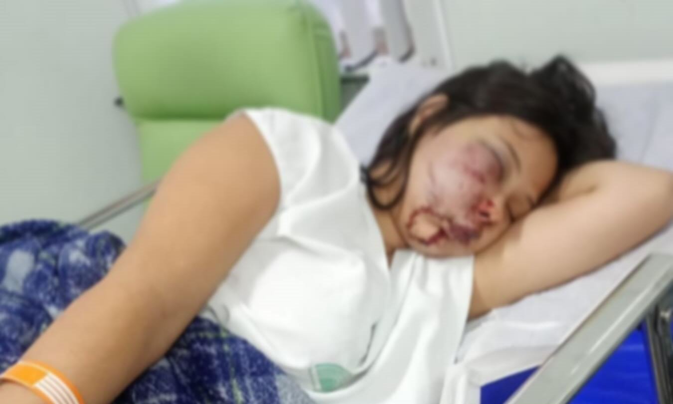 ADOLESCENTE GRÁVIDA É AGREDIDA EM GUARULHOS E CASO DE VIOLÊNCIA CAUSA REVOLTA