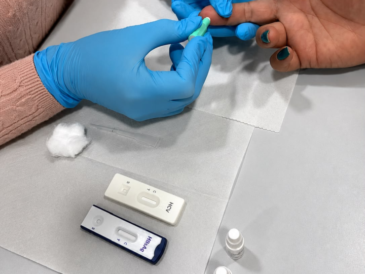 JAGUARIÚNA PROMOVE AÇÕES DO ‘JULHO AMARELO’ COM TESTES RÁPIDOS E ORIENTAÇÕES SOBRE HEPATITES VIRAIS